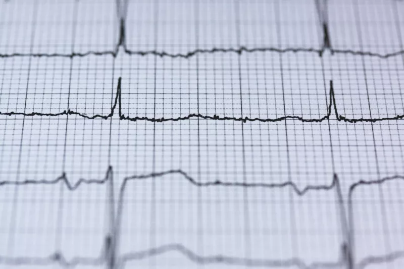 Gesundes Herz-Kreislaufsystem: EKG