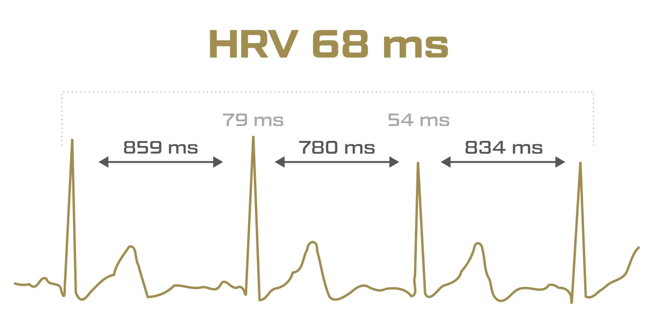 Herzfrequenzvariabilität (HRV): Beispiel Darstellung an einer EKG Kurve